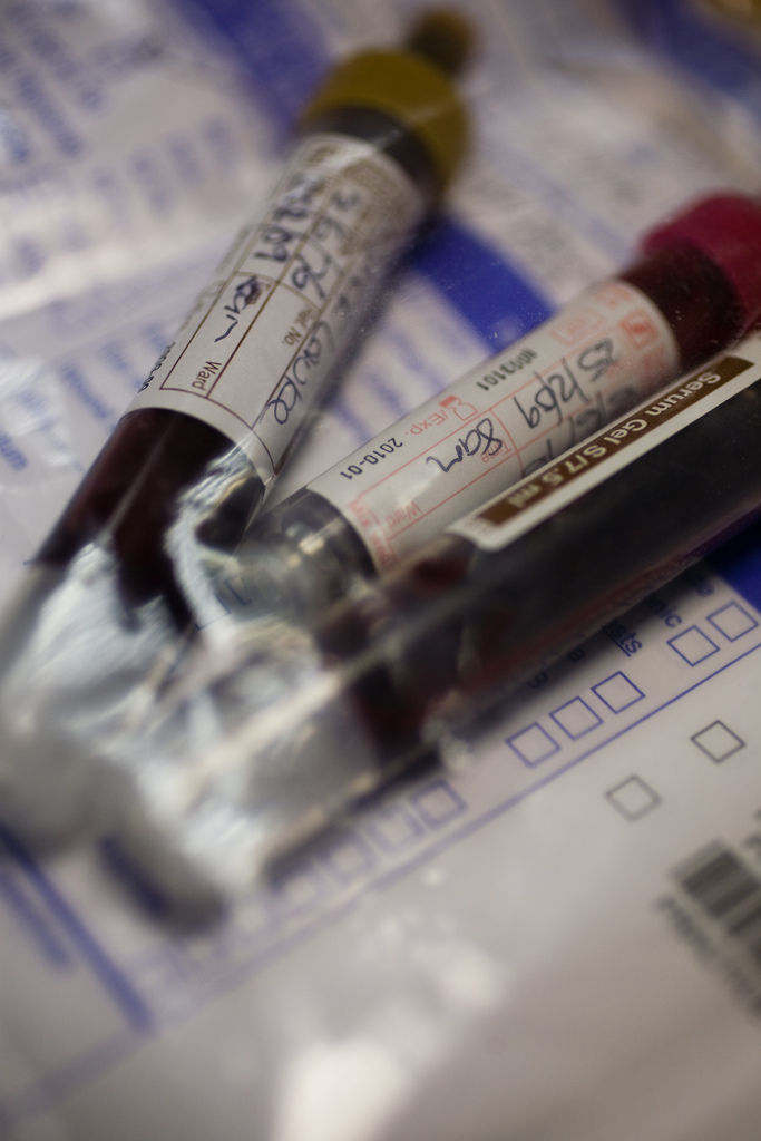 Prédire la ménopause avec un simple test sanguin